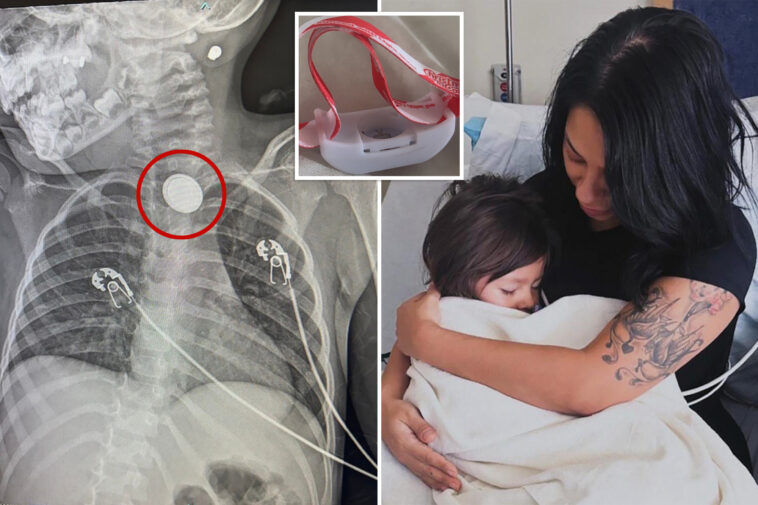 mom-shares-chilling-warning-about-christmas-gifts-after-child-is-hospitalized-for-swallowing-battery
