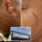 two-nyc-correction-officers-attacked-in-4-hours-at-rikers-—-one-by-menace-accused-of-brutal-subway-assault:-union