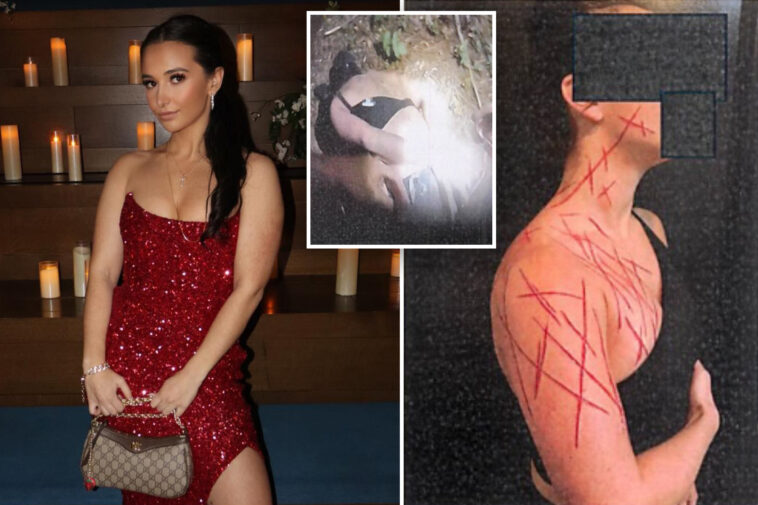 ex-nj-gop-aide-ordered-to-get-mental-help-after-allegedly-brutalizing-herself-in-fake-anti-trump-attack