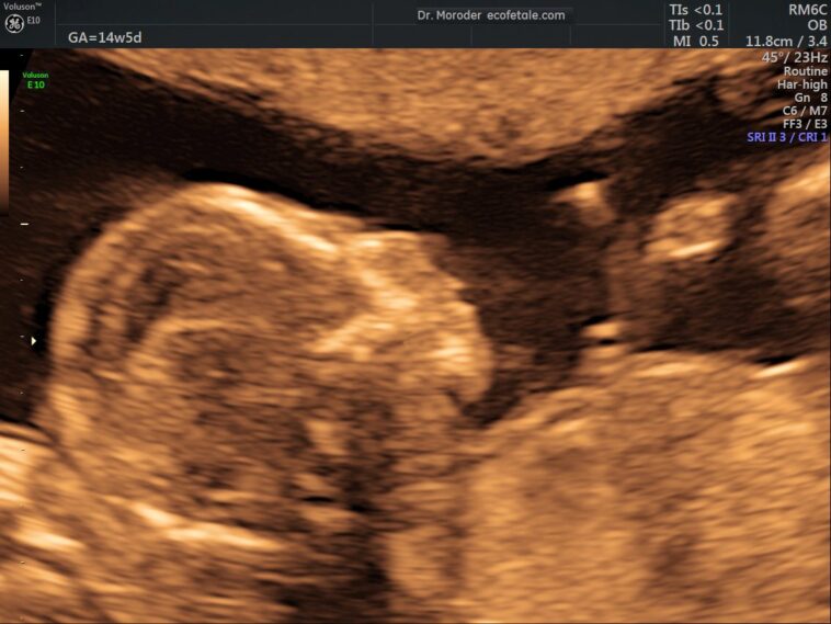 puerto-rico-enacts-groundbreaking-law-recognizing-unborn-babies-as-persons-from-conception