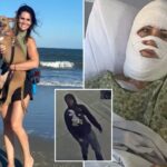 churchgoing-georgia-woman,-46-suffered-severe-burns-in-random-toxic-chemical-attack-while-walking-at-park