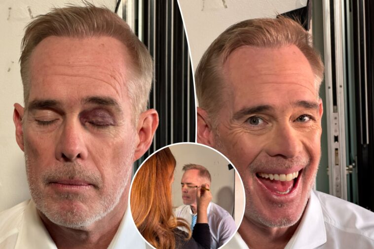 joe-buck-reveals-black-eye-hidden-by-espn-makeup-artist-after-seahawks-49ers-game