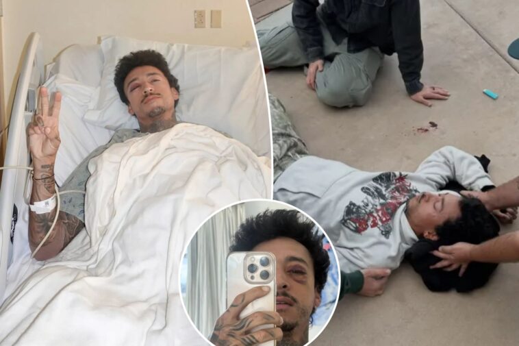 olympic-bronze-medalist-nyjah-huston-suffers-fractured-skull,-eye-socket-in-skateboarding-accident