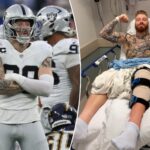 maxx-crosby-undergoes-knee-surgery-after-messy-end-to-his-raiders-season