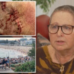 bondi-beach-victim-outraged-after-her-name-was-changed-by-hospital-during-treatment:-‘ripped-of-my-identity’