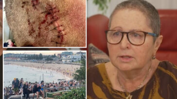 bondi-beach-victim-outraged-after-her-name-was-changed-by-hospital-during-treatment:-‘ripped-of-my-identity’