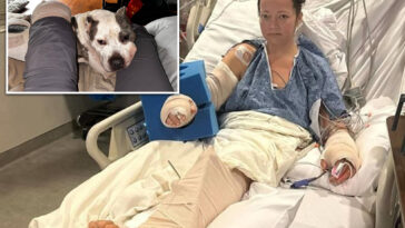 tennessee-mom-loses-leg-in-attack-by-her-own-pit-bull-that-left-limb-‘basically-hanging-off’