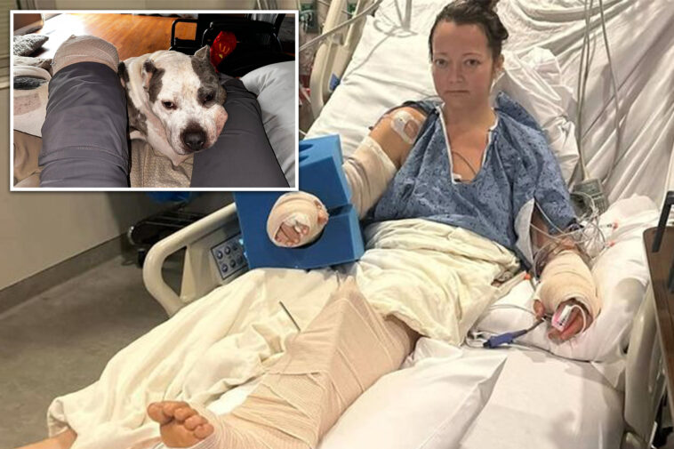 tennessee-mom-loses-leg-in-attack-by-her-own-pit-bull-that-left-limb-‘basically-hanging-off’
