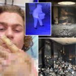 teen-accused-of-torching-mississippi-synagogue-posted-gruesome-selfie-of-severe-burns-hours-after-attack