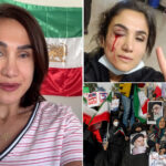 iranian-mom-who-lost-eye-to-bullet-in-2021-hijab-protest-now-lives-in-calif.-—-and-has-desperate-plea-for-trump