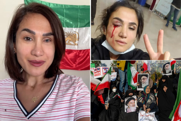 iranian-mom-who-lost-eye-to-bullet-in-2021-hijab-protest-now-lives-in-calif.-—-and-has-desperate-plea-for-trump