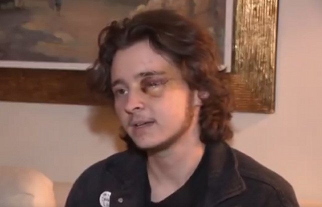 fafo:-ice-protester-in-california-loses-an-eye-after-rushing-agents-and-getting-shot-with-projectile-(video)