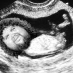 jd-vance-shares-ultrasound-of-4th-child