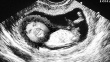 jd-vance-shares-ultrasound-of-4th-child