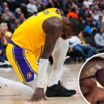 lakers-coach-jj-redick-concerned-over-star-player’s-eye-injury:-‘he-looks-like-a-pirate’