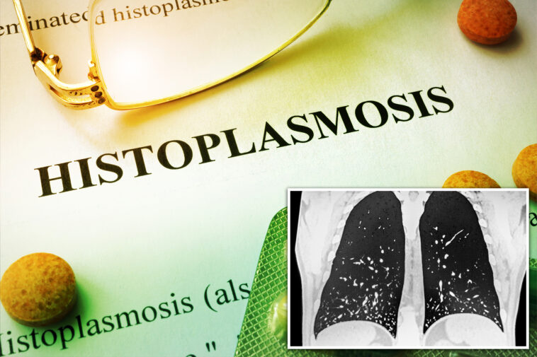 potentially-deadly-fungus-leaves-dozens-sickened-as-infection-spreads-across-tennessee