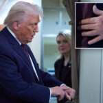 trump-reveals-how-he-got-large-bruise-on-his-hand-as-he-trashes-health-conspiracies