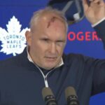maple-leafs’-craig-berube-shows-off-terrifying-cut-after-gym-accident