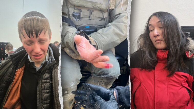 anti-ice-agitator-allegedly-bites-off-federal-officer’s-finger-during-minneapolis-attack