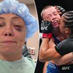 ufc-star-rose-namajunas-won’t-be-able-to-blow-nose,-sneeze-for-three-months-after-gruesome-injury
