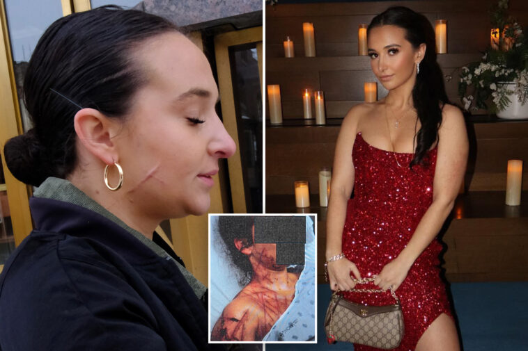 ex-nj-gop-aide-still-carries-visible-scars-after-she-paid-fetish-artist-to-carve-her-up-as-part-of-trump-attack-hoax