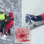 lindsey-vonn-injured-after-crash-in-final-downhill-race-week-before-2026-winter-olympics