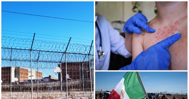 texas-ice-facility-placed-under-quarantine-after-measles-cases-confirmed-among-illegal-alien-detainees