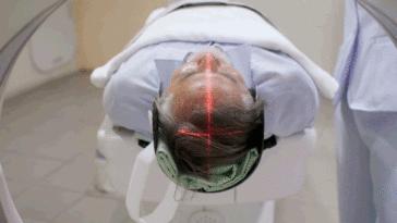 hidden-brain-condition-may-quadruple-dementia-risk-in-older-adults,-study-suggests