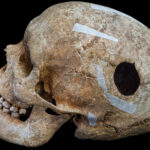 discovery-of-viking-era-man’s-skull-points-to-evidence-of-world’s-first-surgical-procedure