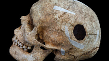 discovery-of-viking-era-man’s-skull-points-to-evidence-of-world’s-first-surgical-procedure