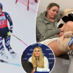 lindsey-vonn-to-compete-at-the-winter-olympics-with-a-torn-acl-—-doctors-detail-the-obstacles-she-will-face