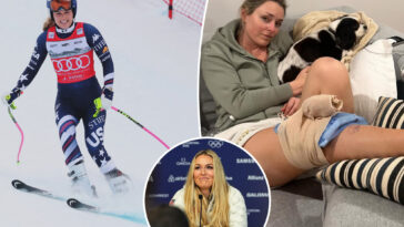 lindsey-vonn-to-compete-at-the-winter-olympics-with-a-torn-acl-—-doctors-detail-the-obstacles-she-will-face