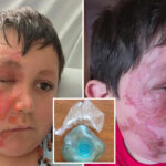 boy,-9,-severely-burned-after-microwaving-needoh-sensory-toy-in-resurfaced-tiktok-trend