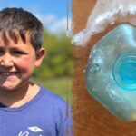 dangerous-tiktok-trend-leaves-boy-badly-burned-as-doctors-issue-warning