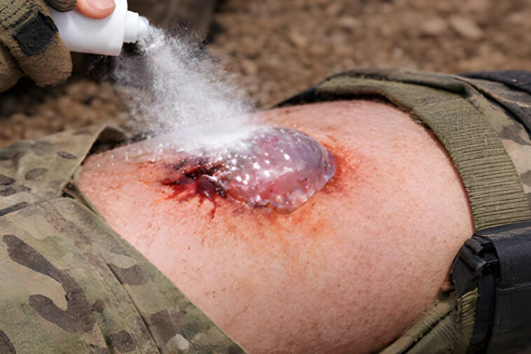 south-korean-scientists-create-life-saving-spray-to-stop-bleeding-instantly