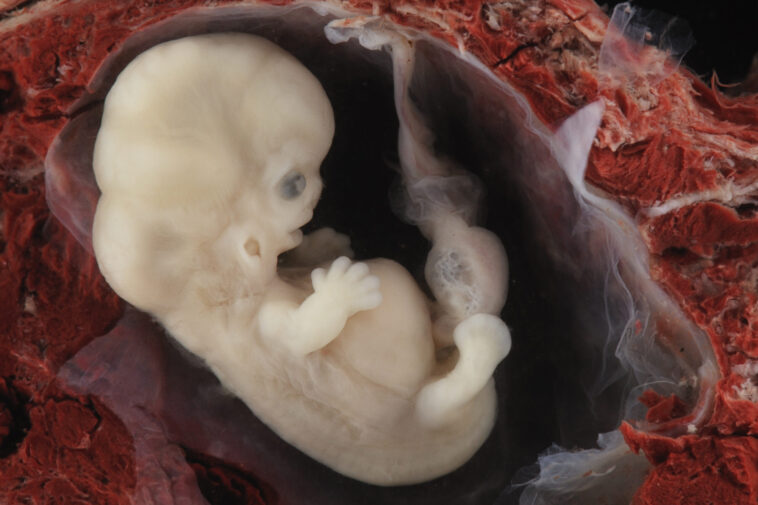 abortion:-“it’s-just-a-clump-of-cells”-that-happens-to-be-a-baby
