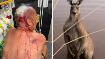 australian-man-‘lucky-to-be-alive’-after-beaten-to-pulp-in-violent-kangaroo-attack