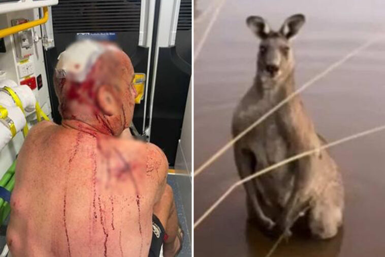 australian-man-‘lucky-to-be-alive’-after-beaten-to-pulp-in-violent-kangaroo-attack