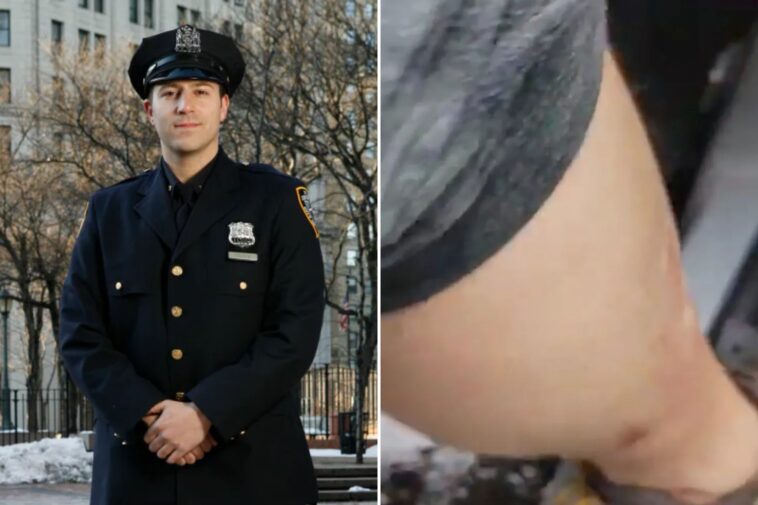 nypd-cop-suing-mcdonald’s-over-scalding-hot-coffee-burn-that-caused-his-skin-to-‘peel-off’-—-echoing-famous-‘90s-case