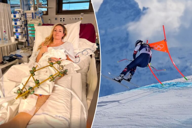 expert-has-amputation-worries-after-seeing-lindsey-vonn’s-hospital-photo-following-olympics-crash