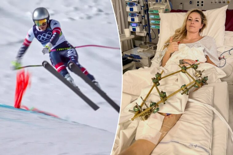 lindsey-vonn-returning-to-us-after-revealing-fourth-surgery-‘went-well’