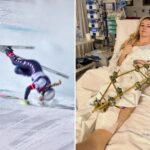 as-lindsey-vonn-faces-a-long-recovery,-this-is-the-toll-the-olympics-takes-on-athletes’-bodies