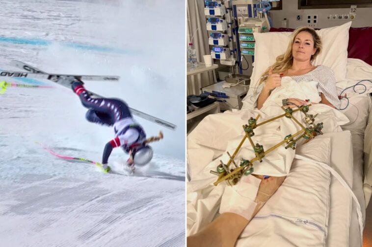 as-lindsey-vonn-faces-a-long-recovery,-this-is-the-toll-the-olympics-takes-on-athletes’-bodies
