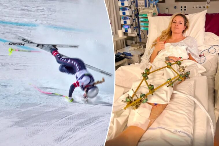 lindsey-vonn-set-for-‘further-surgeries’-after-flying-back-to-us