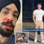 nurse-left-with-broken-nose-in-‘racist’-ambush-attack-at-gym