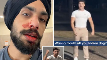nurse-left-with-broken-nose-in-‘racist’-ambush-attack-at-gym
