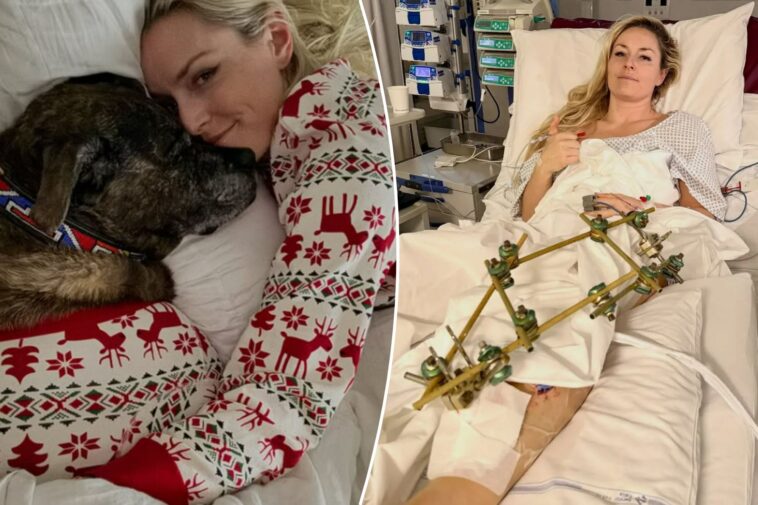 lindsey-vonn-reveals-her-dog-died-a-day-after-her-horrific-olympic-crash-in-heartbreaking-post:-‘my-first-love’