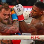 screws-loose,-paul-undergoes-second-jaw-surgery