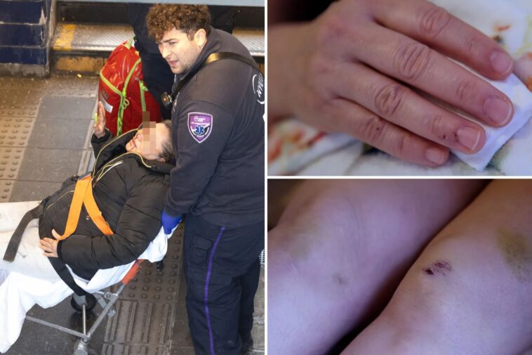 woman-shoved-onto-nyc-subway-tracks-by-crazed-attacker-slams-mamdani’s-safety-plan:-‘i-was-facing-death’