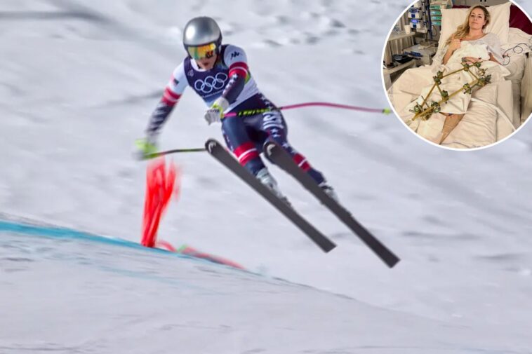 lindsey-vonn-claps-back-at-‘haters’-as-she-recovers-from-leg-surgeries-after-olympic-crash